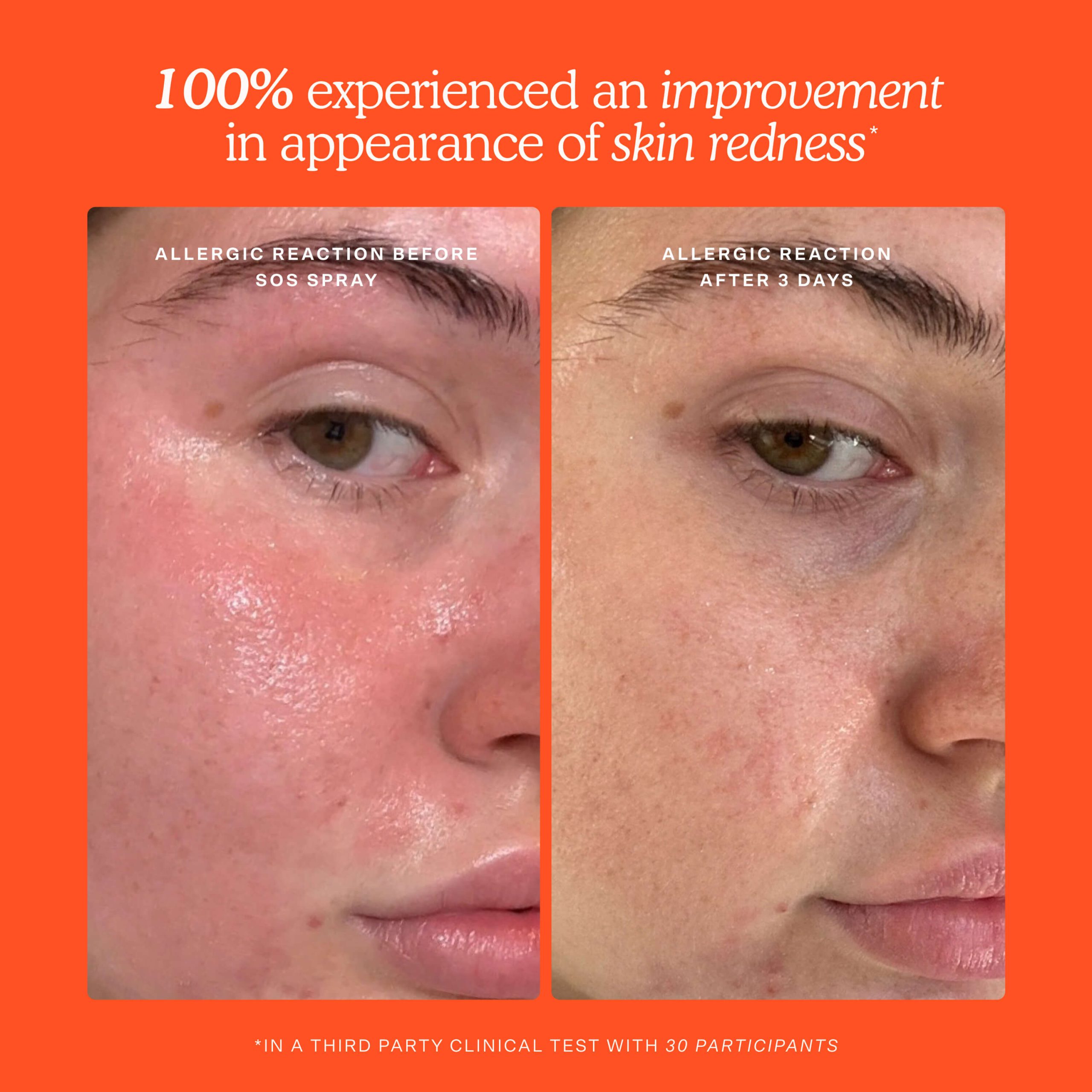 SOS Skincare Minis Kit - Image 4