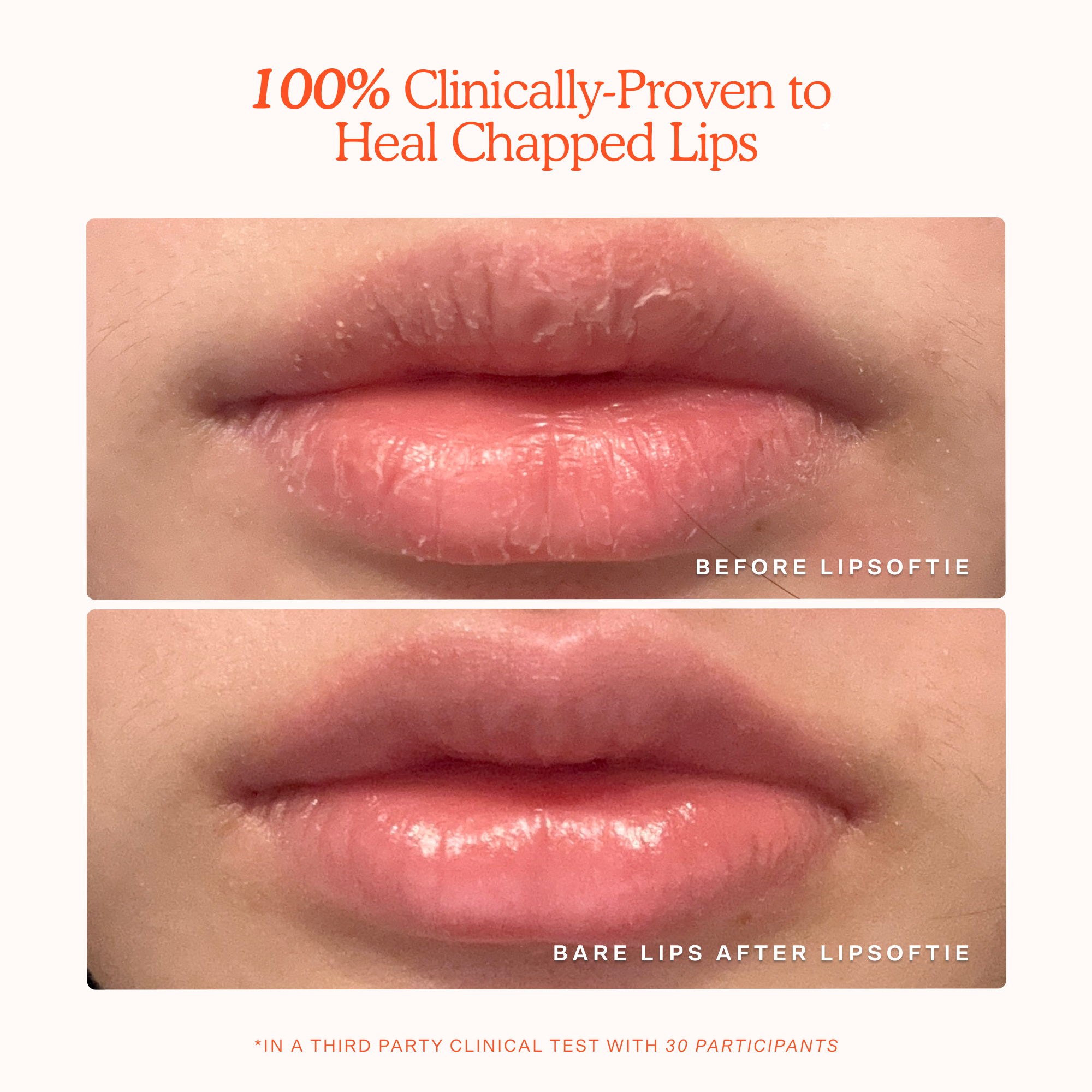 LipSoftie Lip Treatment - Image 4