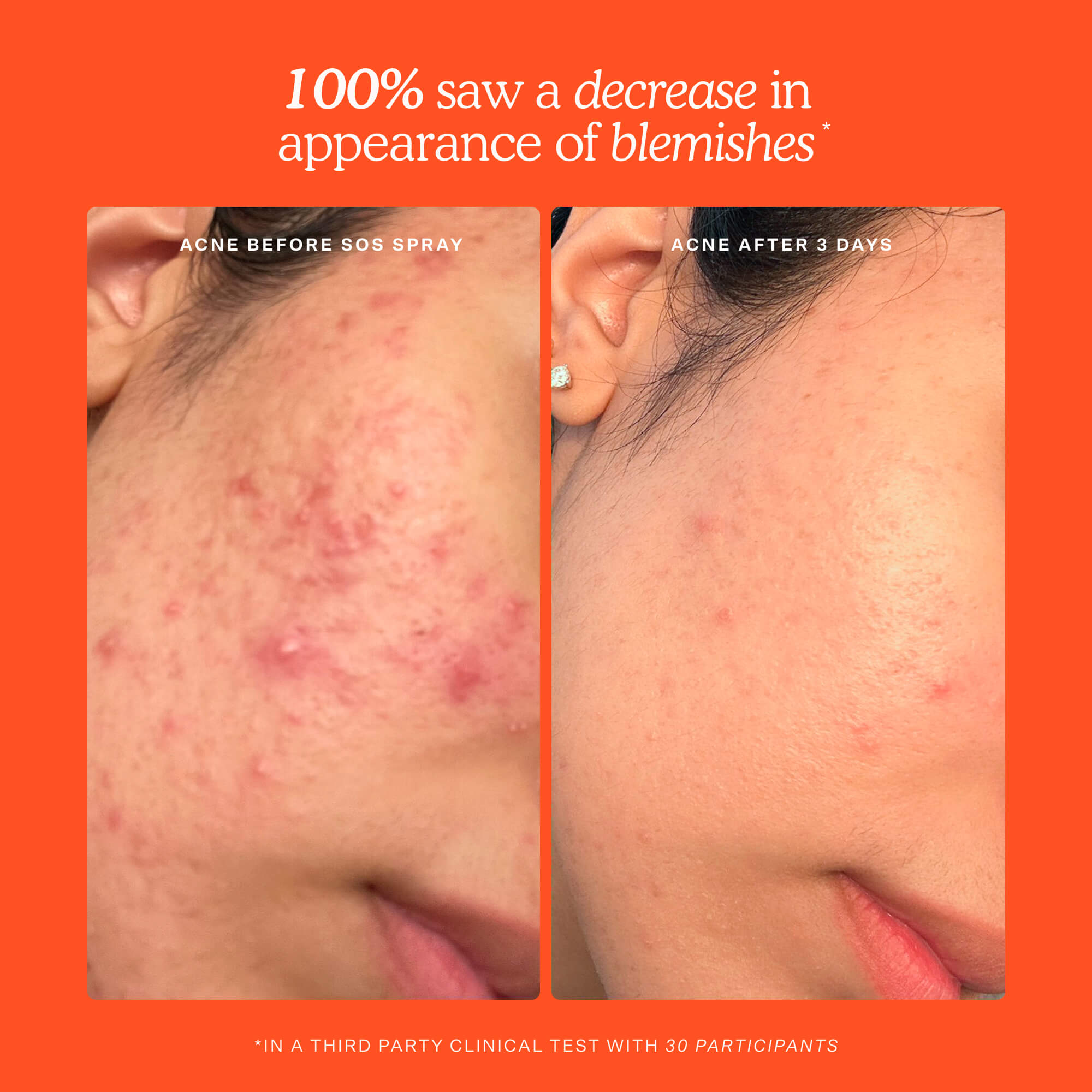 SOS Skincare Minis Kit - Image 3