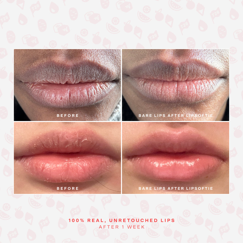 LipSoftie® Lip Treatment Set - Image 8