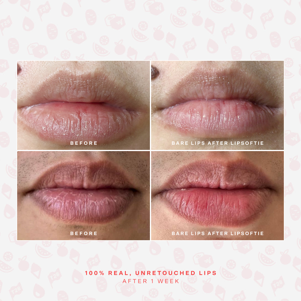 LipSoftie® Lip Treatment Set - Image 7