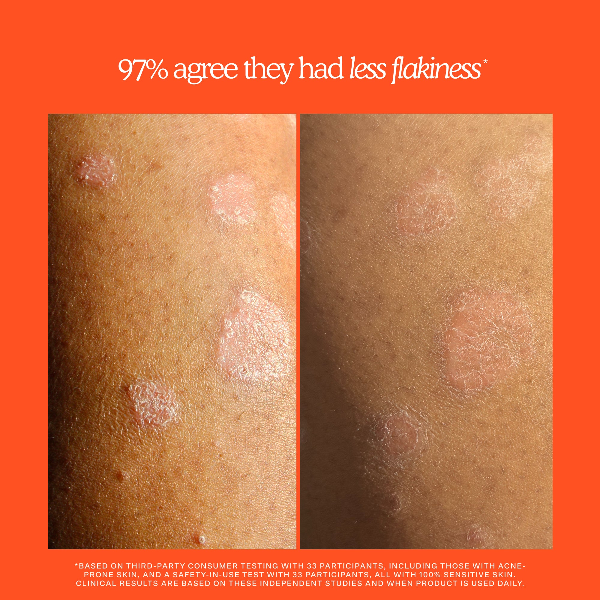 SOS Rescue + Relief Body Wash Treatment - Image 4